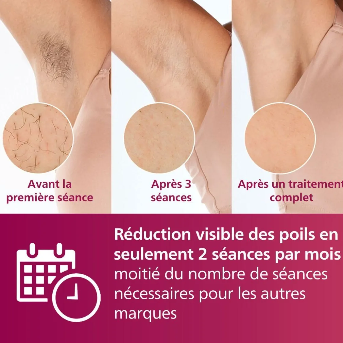 Epilateur lumière pulsée IPL BRI920/00 series 7000