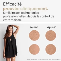 Epilateur lumière pulsée IPL PL5052